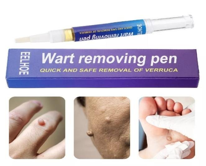 Wart Removal Pen in Pakistan - Image