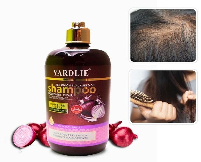 Yardlie Professional Red Onion Shampoo Price in Pakistan - Image