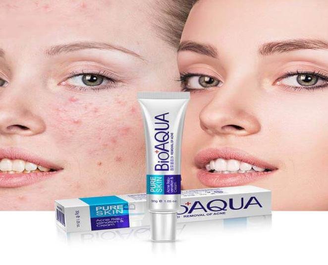 Bioaqua Pure Skin Acne Removal Cream Acne Cream Price in Pakistan - Image