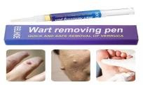 Wart Removal Pen in Pakistan