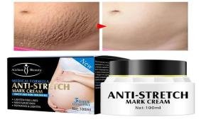 https://bwpakistan.com/Aichun-Beauty-Anti-Stretch-Mark-Cream-Price-in-Pakistan