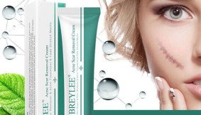 Breylee Acne Scar Removal Cream Price in Pakistan