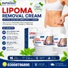 Lipoma Removal Cream image 2