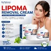 Lipoma Removal Cream image 1